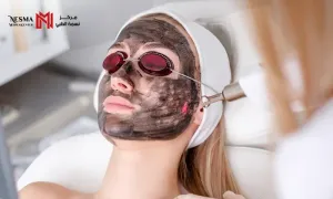 nesma-medical_dealimage_health-clinic_carbon-laser-copy.webp