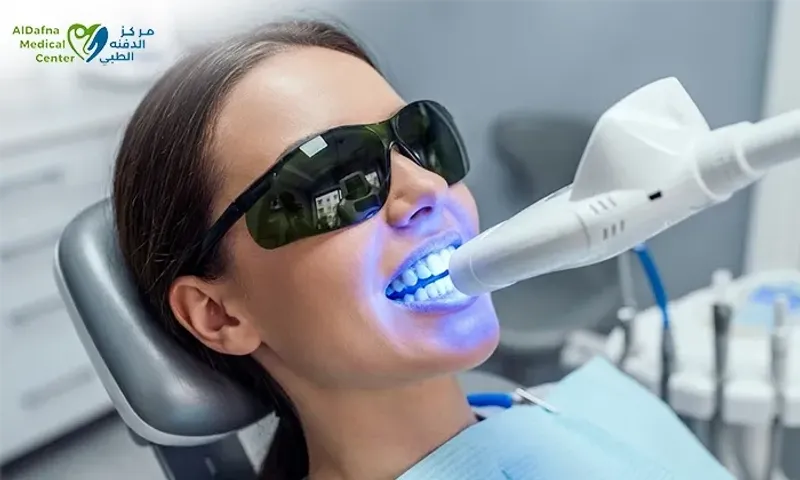 Whiter Smile with Professional Teeth Whitening at Al Dafna Medical Center!