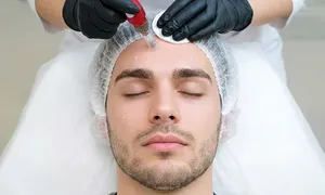 austin-medical-dealimage_health-clinic-_microneedling-prp-3.jpg