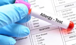 dafna-medical_-dealimage_health_-food-intolerance-test-2copy.jpg