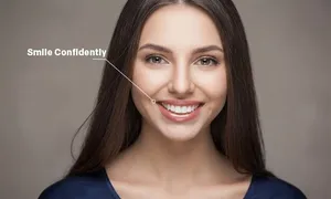 avenues-dental_-dealimage_health_2veneer.jpg