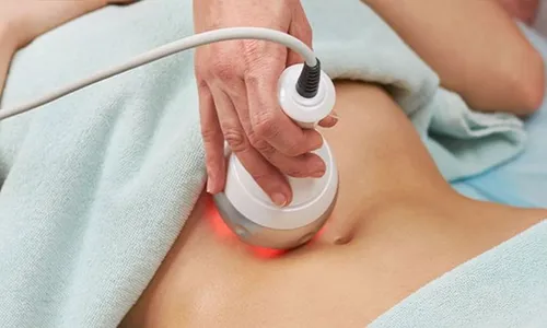 No Surgery, Just Results! Venus Legacy Body Contouring for Ladies and Men!