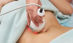 diet-cafe_dealimage_health-clinic_venus-legacy-body-contouring-2-copy.jpg