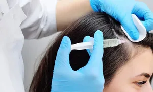 queens-derma_-dealimage_healthandclinic_prp-hair3.jpg
