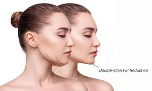 queens-derma_-dealimage_healthandclinic_mesotherapy-3-copy.jpg
