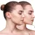 queens-derma_-dealimage_healthandclinic_mesotherapy-3-copy.jpg