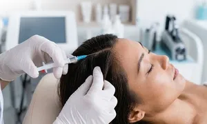 dafna-medical_-dealimage_health_mesotherapy-prp-2-copy.jpg
