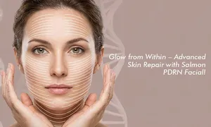 nesma-medical_dealimage_health-clinic_age-skin-boost-salmon-pdrn-aesthetic-c2opy.jpg