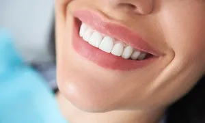 al-kindi-clinic_dealimage_health-clinic-_zoom-teeth5-copy.jpg