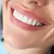 al-kindi-clinic_dealimage_health-clinic-_zoom-teeth5-copy.jpg