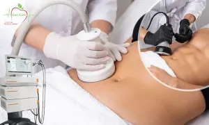 diet-cafe_dealimage_health-clinic_cellulite-reduction-2-copy.webp