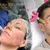 austin-medical-dealimage_health-clinic-_microneedling-prp-7.jpg