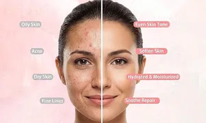 simply-beauty-spa_dealimage_mask-jelly-rose-2-opy.jpg