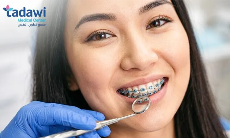 Metal Braces, Adjustment, Retainer & Consultation at Tadawi Medical Center!