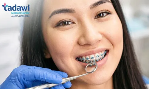 Metal Braces, Adjustment, Retainer & Consultation at Tadawi Medical Center!