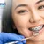 tadawi_dealimage_health-clinic_braces-copy.jpg