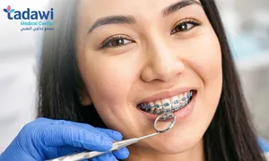 tadawi_dealimage_health-clinic_braces-copy.jpg