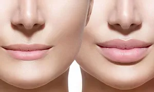 nesma-medical_dealimage_health-clinic_lips-3-copy.jpg