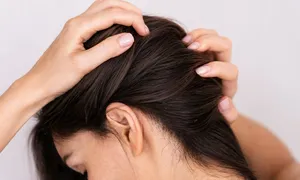lavaes-beauty-land-anti-dandruff-deal-image-02.jpg