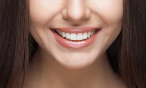 alpha-dental_-dealimage_health_flash-teeth-4-copy.jpg