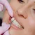 avenues-dental_-dealimage_health_acne-veneer-copy.jpg
