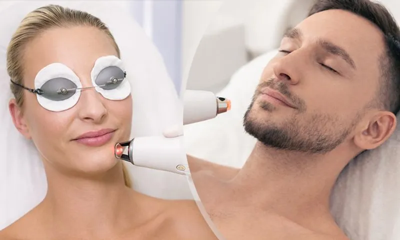 Skin Renewal: Frax Pro Laser for Ladies & Gents at Queens Dermatology Center!