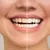 al-bidaa_dealimage_health-and-clinic_zoom-teeth-white-5-copy.jpg