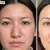 austin-medical-dealimage_health-clinic-_microneedling-prp-4.jpg