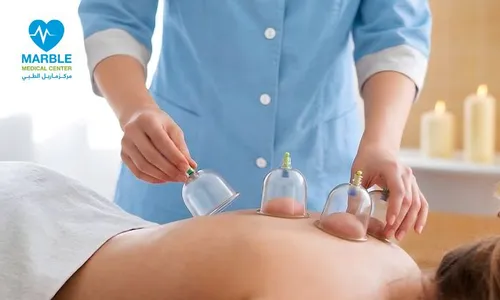 Rejuvenate & Detox with Dry Cupping at Marble Plus Medical Center!