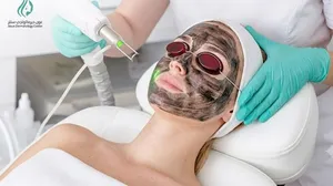 Deep Skin Brightening & Rejuvenation with Carbon Laser at Aoun Dermatology Center!