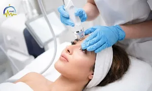 al-aqsa-_deal-image_healthn-clinic-_microneedle-copy.jpg