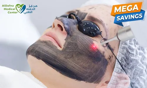 Mega Savings: Spectra Carbon Laser & Bleaching for Ladies & Men at Al Dafna Medical Center!