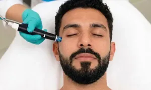 ultra-cosmetic-medical-center_-dealimage_health_hydrafacial-1-copy.webp