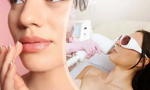 Fractional Laser for Rosy Lips at Marble Plus Medical Center!