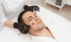 al-shefa_dealimage_beauty-spa_chemical-2.jpg