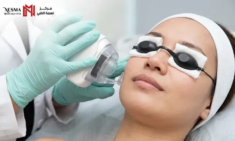 Reduce Scars, Lines & Uneven Texture with Fractional CO2 Laser at Nesma Medical Center