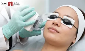 nesma-medical_dealimage_health-clinic_fractional-co2-copy.webp