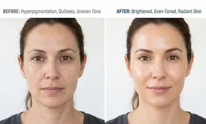 lavaes-beauty_deal-image_beauty-spa-_hydrafacial--3.jpg