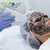 spectra-carbon-laser-bleaching-al-dafna-medical-center-22873