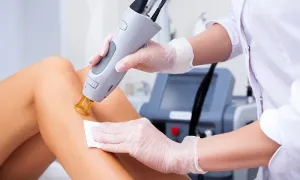 austin-medical-dealimage_health-clinic-_-laser-hair-removal-copy.webp