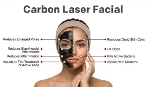 nesma-medical_dealimage_health-clinic_carbon-laser-2-copy.webp