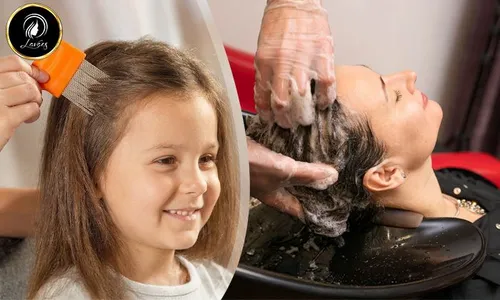 Nits & Lice Treatment for Kids & Ladies at Lavaes Beauty Land!