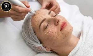 lavaes-beauty_deal-image_beauty-spa-_hydrafacial--1.jpg