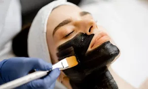 dafna-medical_-dealimage_health_carbon-laser-2-copy.jpg