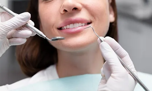 Dental Services: Scaling, Polishing, X-Ray & Consultation!