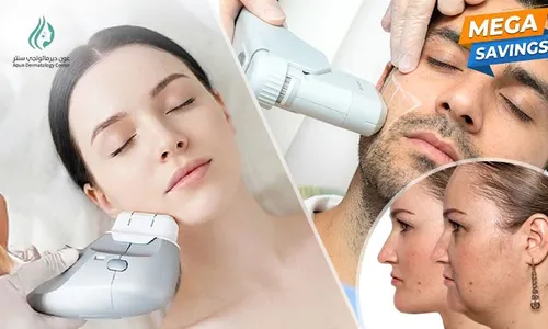 HIFU Skin Tightening for Ladies & Men at Aoun Dermatology Center!