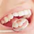 elegant-smile_dealimage_health-clinic-1.jpg