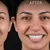 zone-medical-centre_dealimage_health-clinic_dental-implant-3.jpg