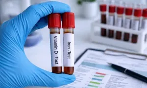 dafna-medical_-dealimage_health_vitamin-d-and-iron-test-3-copy.webp