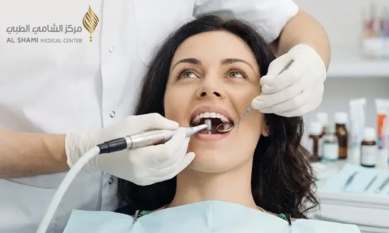 Teeth Scaling & Polishing at Al Shami Medical Center!